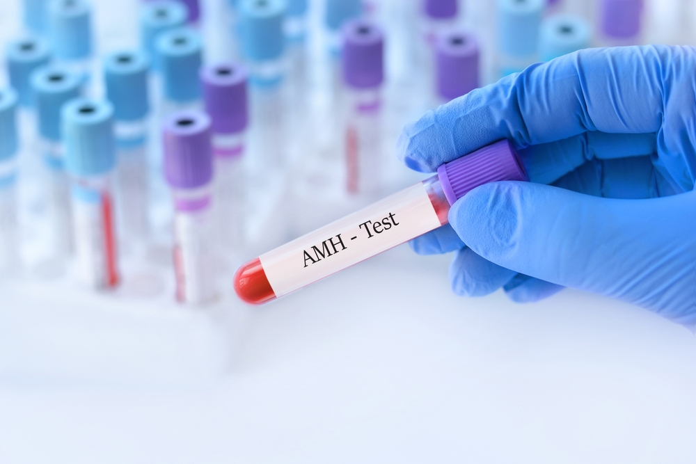 AMH test: Sve što treba da znate o proceni plodnosti