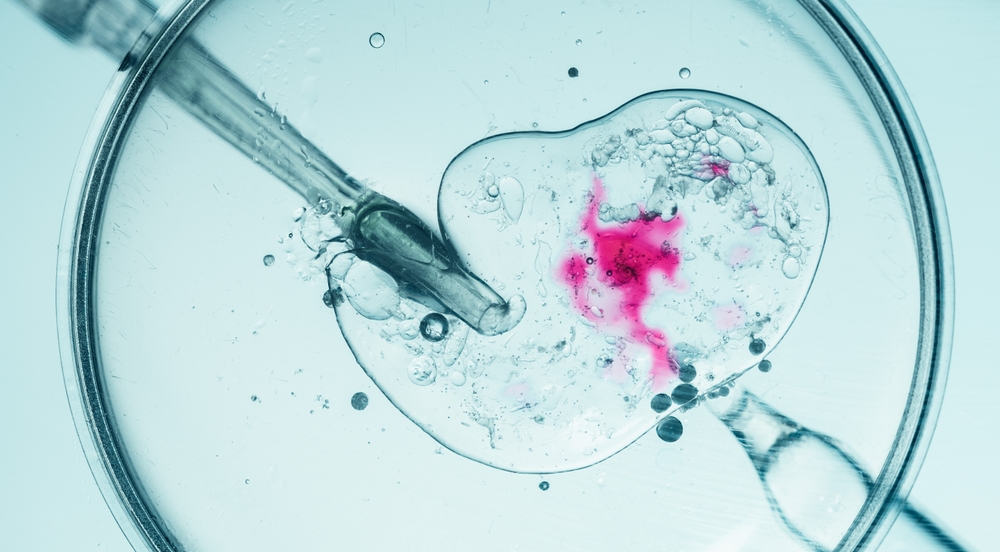 Šta je tačno vantelesna oplodnja (VTO)