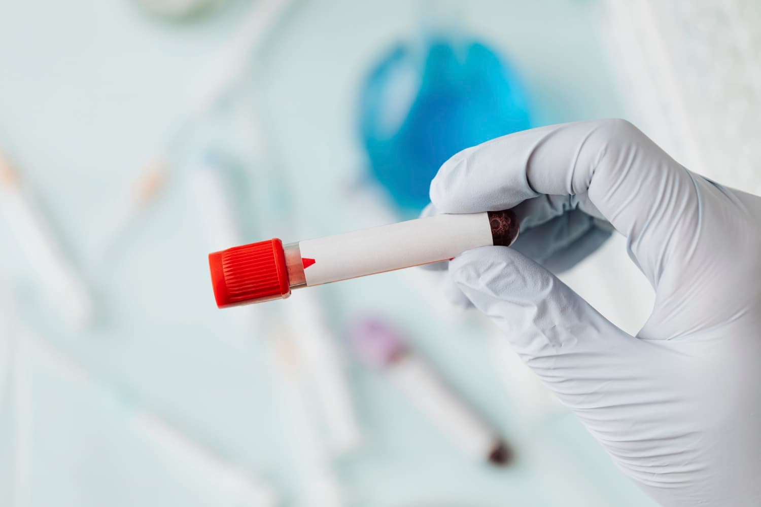 privatna laboratorija